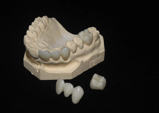 high translucent zirconia