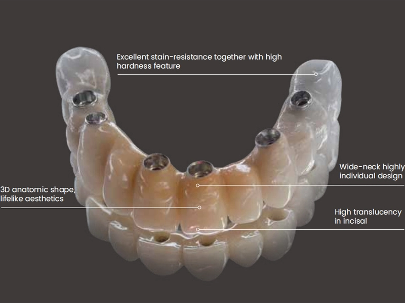 Focus sur la recherche sur la dentisterie numérique, pour fournir des solutions dentaires à guichet unique