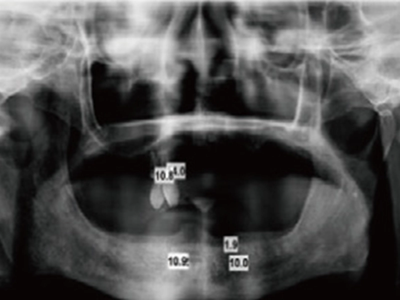 1. Prenez la radiographie