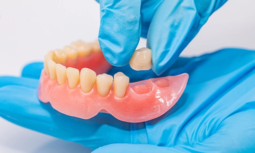 Comment les dents de prothèse artificielle améliorent la qualité de vie